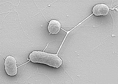 大肠杆菌显微镜下图片图片